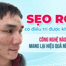 Trị Sẹo Rỗ Hiệu Quả #1 – Phác Đồ Chuẩn Da Liễu Từ A–Z